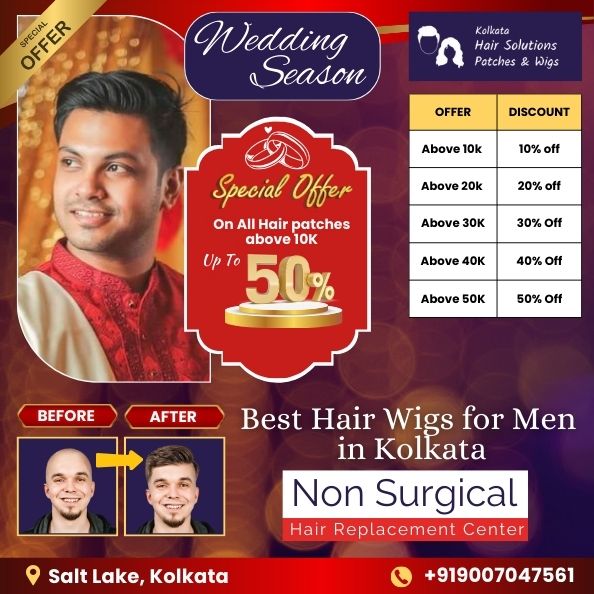 Get up to 50% off on all hair wigs and hair patches for men at kolkata hair solutions, salt lake, kolkata this wedding season. Kolkata hair solutions is the top non-surgical hair replacement center in Kolkata, which is located in salt lake city. This is the best offer on hair wigs and hair patches in Kolkata. You get best non-surgical solutions of hair fall problems in men in kolkata.