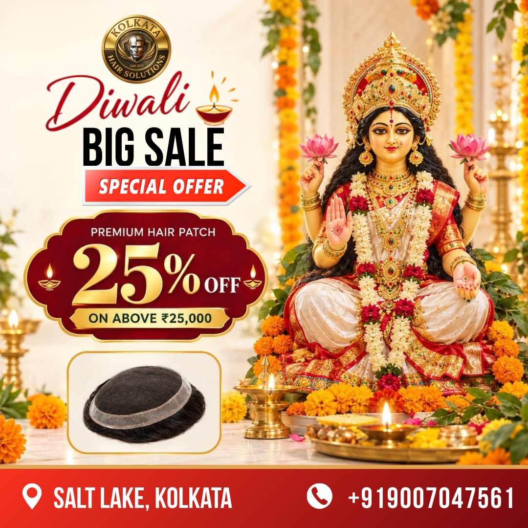 Diwali Special Offer on Premium Men's Hair Patch – 25% Off on Hair Patches Above ₹25,000